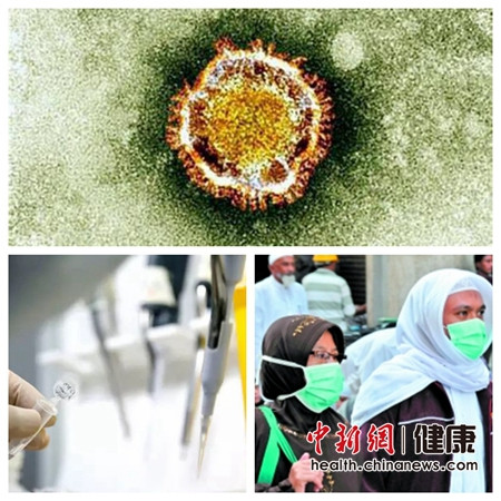 ��������MERS���Б�(y��ng)���A(y��)������:�ɷ��ɿز��ؿֻ�