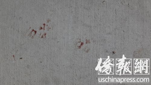 �Tǰˮ�����������Ҋ�׵�Ѫ�E��(�������S��(b��o)��/��� �z)