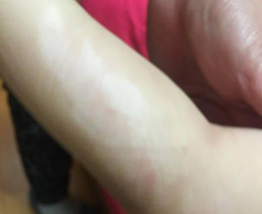 小學生遭導師拿熱水壺燙醒 小學生遭導師拿熱水壺燙醒