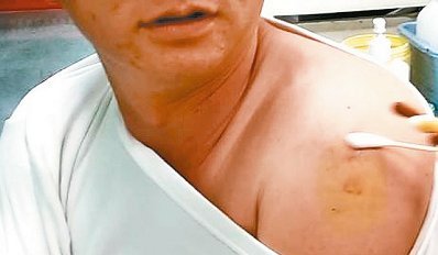 男子打針想自拍遭拒護理師:我的手是隱私(圖)