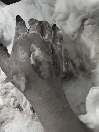 Ů�Ӳ���Ӣ���e�uʯ��ۺ�17�q��Ů���؟�������֫