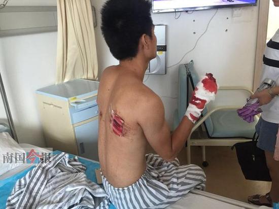 柳州一發廊煤氣爆燃4人受傷 沖擊波