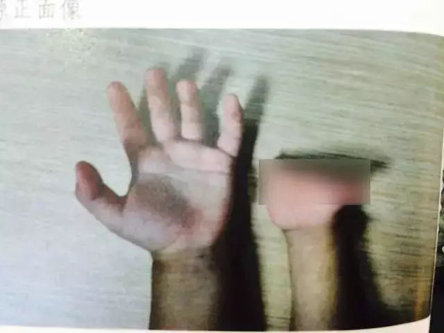 孕婦多次產(chǎn)檢仍生下唇腭裂女兒 家屬要求醫(yī)院擔(dān)責(zé)