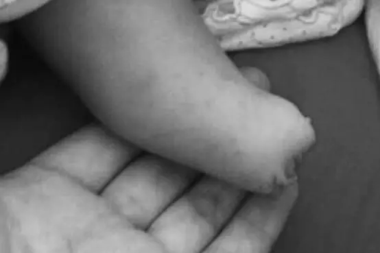 孕婦多次產(chǎn)檢仍生下唇腭裂女兒 家屬要求醫(yī)院擔(dān)責(zé)