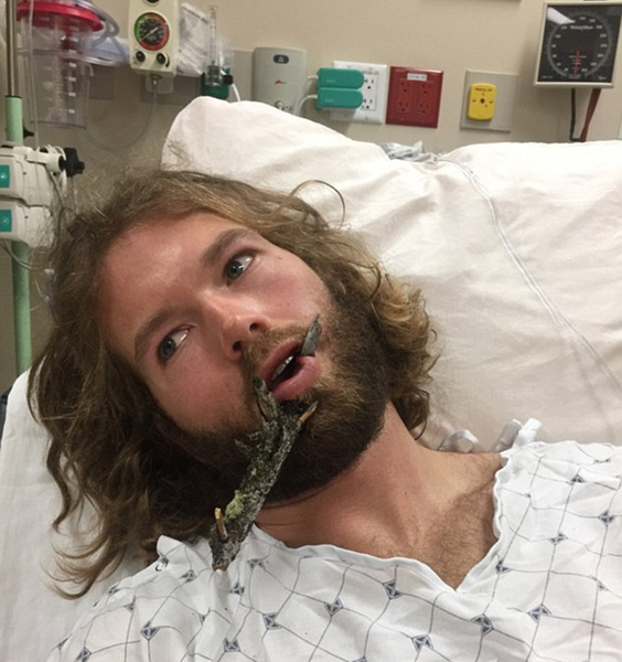 ����ѩ�̾���ѩ�r������ �촽����֦�̴�