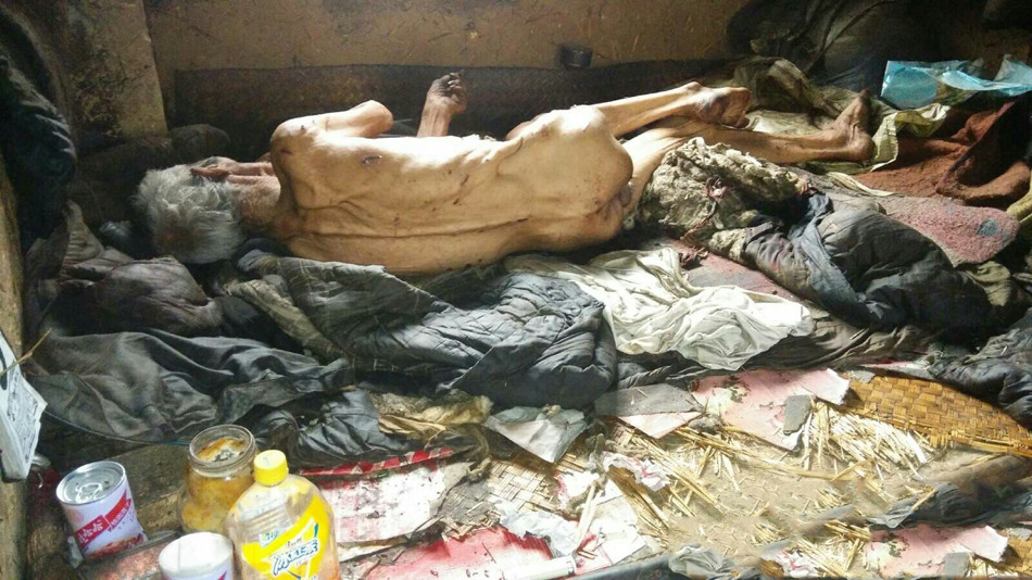 山東平度一孤寡老人無人照顧 被餓到皮包骨(組圖) 山東平度一孤寡老人無人照顧 被餓到皮包骨(組圖)